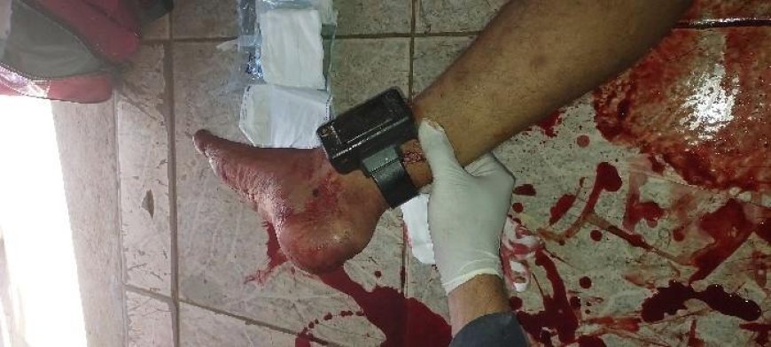 Tentativa de homicídio em Porto Velho: vítima é baleada no tornozelo e socorrida