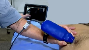 Equipamentos com tecnologia de IA agilizam exames no&hellip;