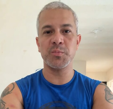 Servidor do Detran afirma nas redes sociais ter sido infectado por Mpox em Porto Velho.