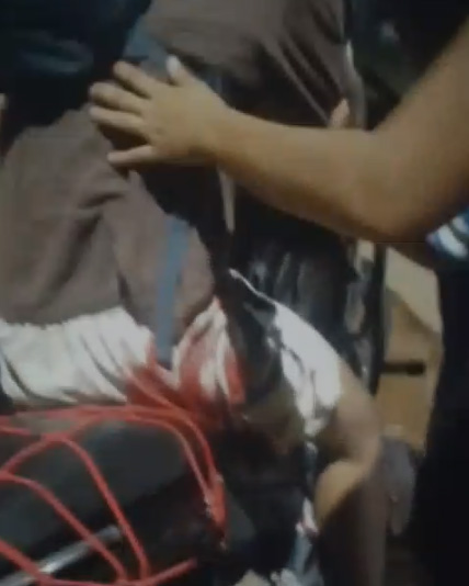 Criminoso sai da mata e atira contra trabalhador em Porto Velho