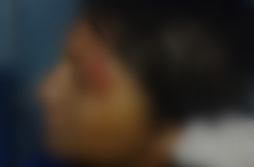 JOVEM É BRUTALMENTE AGREDIDA PELO&hellip;