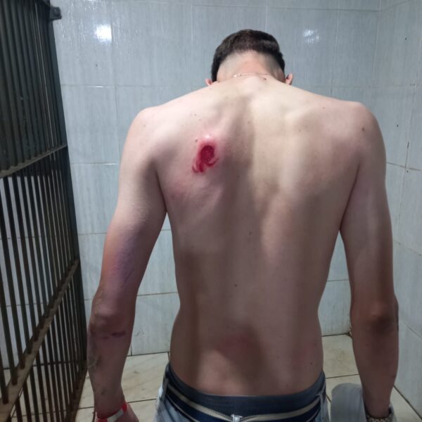 Motociclista Embriagado Foge da Polícia, Cruza Ruas na Contramão e Só é Detido na Entrada de Condomínio em Porto Velho