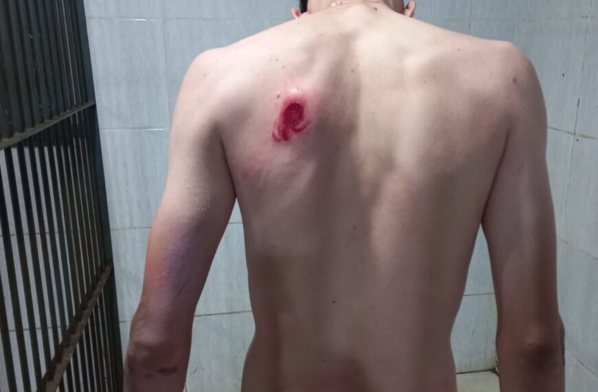 Motociclista Embriagado Foge da Polícia, Cruza Ruas na Contramão e Só é Detido na Entrada de Condomínio em Porto Velho