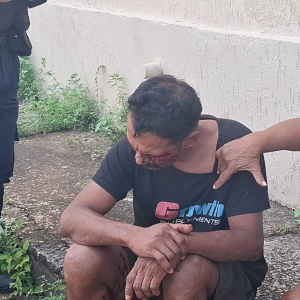 HOMEM EM SITUAÇÃO DE RUA SOFRE QUEDA E É SOCORRIDO NA REGIÃO CENTRAL DE PORTO VELHO